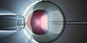 2022年深圳供卵试管婴儿大概多少费用？附全流程花费明细