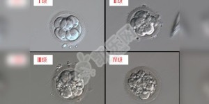 试管婴儿2022年的成功率是多少（附不同年龄的试管成功率）