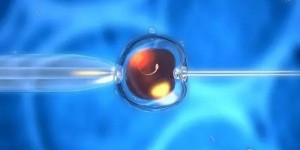 2022年在自贡做试管婴儿大概多少钱？