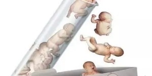 在上海仁济医院做试管婴儿全下来多少钱？