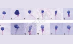 畸形率高98%还能生育吗 怀孕了会是畸形？
