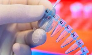 三代试管婴儿gpd筛查费用明细