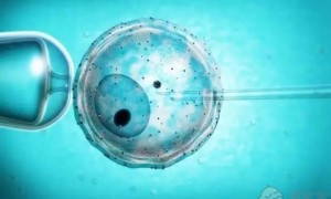 重庆妇幼试管三代费用多少钱一次？附试管价格明细
