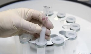 试管婴儿人工周期方案移植前子宫内膜是不是都是C型？