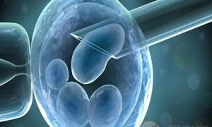 2022年杭州哪家医院可以做试管婴儿？哪家可以做三代试管？
