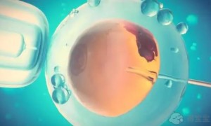有性生活打九价一定要妇科检查吗？