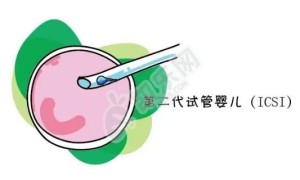 兰州大学第二医院能不能做三代试管婴儿