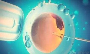 巧克力囊肿可以怀孕吗？会影响到受孕结果吗？
