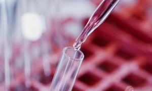 试管超长方案促排要打几天促排针 与短方案相比哪个好