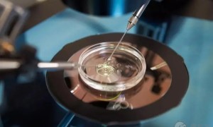 2022年淄博市妇幼保健院做试管婴儿的费用要多少钱？