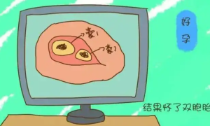多囊促排怀双胞胎经验分享，附注意事项汇总