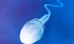 三分钟带你了解精子质量的评判标准，颜色偏黄也能生育