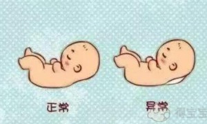 先天性没有输精管的男性可以选择二代试管技术助孕吗