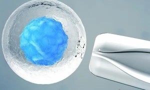 怀孕12周建档要注意的事项有哪些