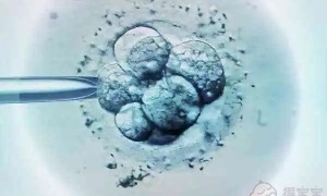 做第三代试管婴儿需要做哪些检查？要带什么证件？