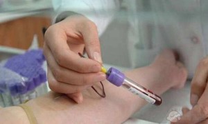 2022武汉市中心医院人工授精生男孩费用明细