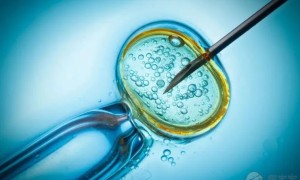 34做试管取卵的时机怎么确定？