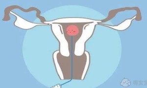 2022年成都能进行第三代试管的医院名单，3家医院满足助孕要求